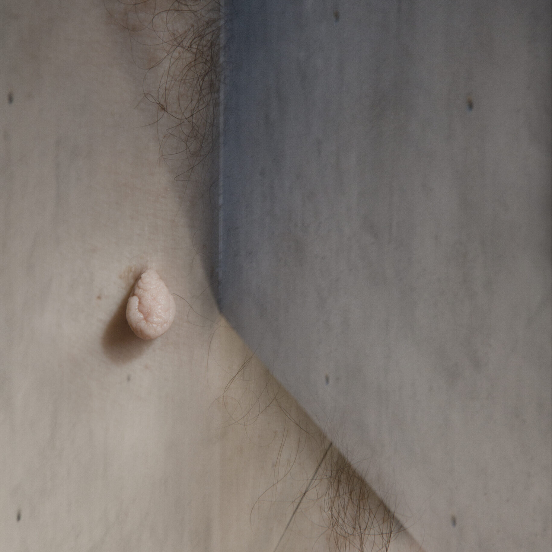 Image © Jane Finlay, The Amoorous Lump